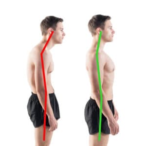 Posture Alignment Therapy - The POSTURE Clinic