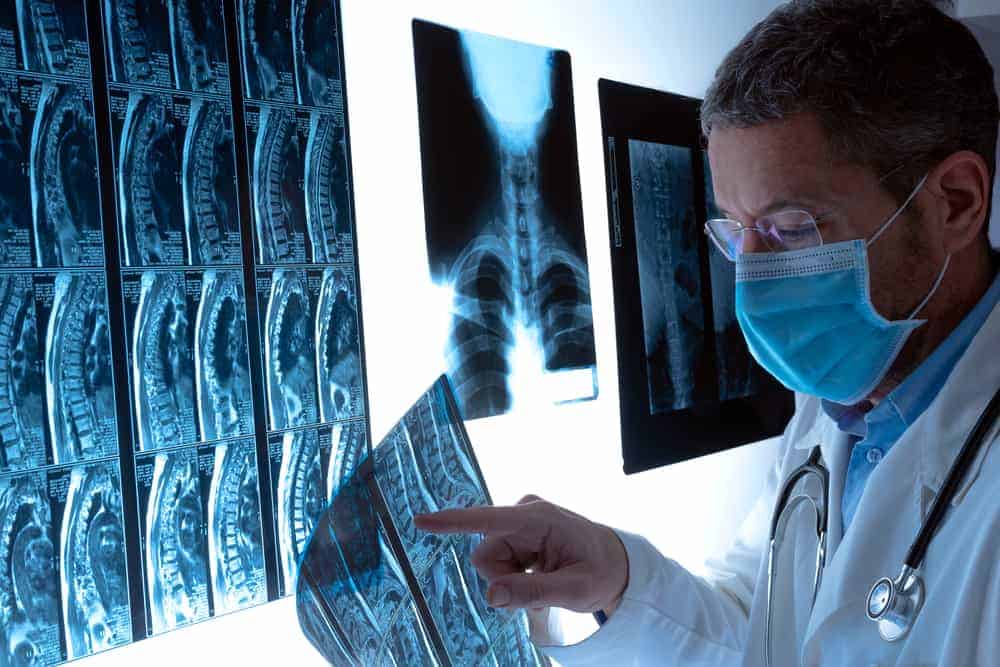 Understanding a healthy spine vs unhealthy spine