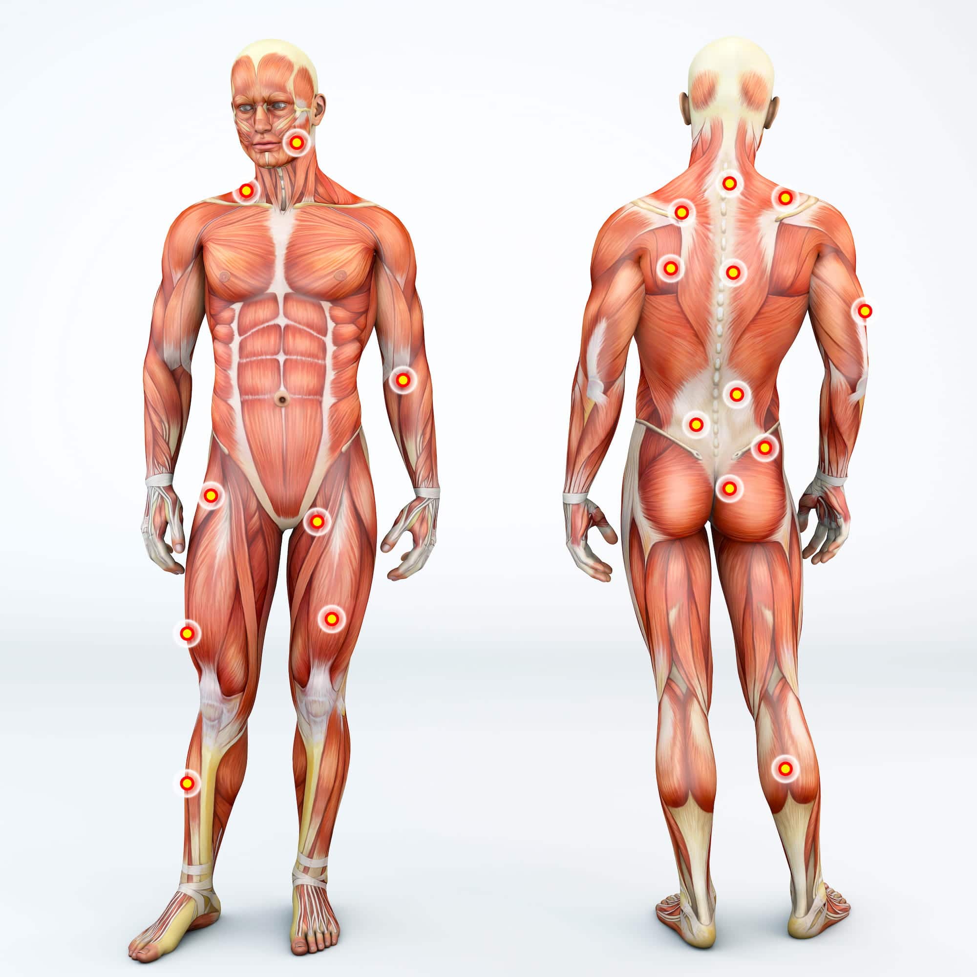 erector spinae trigger points